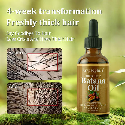 Gypsophila® BATANA OIL SHAMPOO & BATANA OIL FOR HAIR GROWTH